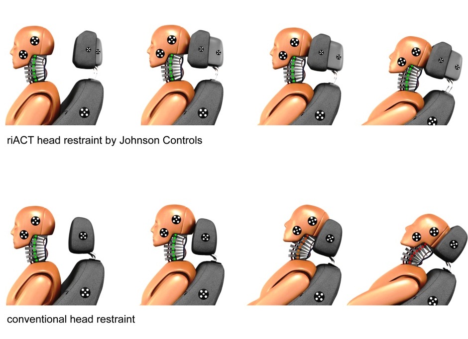 Active Headrests Fight Cervical Spine Syndrome